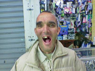 este pobrecillo esqe se le a caio el pelo i fua despre